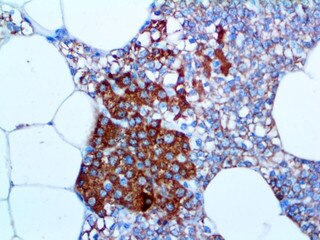 IHC of Parathyroid Hormone on an FFPE Parathyroid Tissue